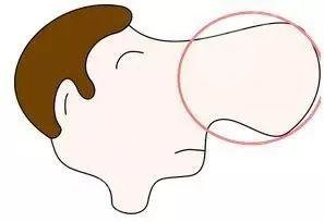 北京沃尔医疗美容医院怎么样地址刘彦军做鼻子案例价格表来袭