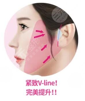 拉皮手术