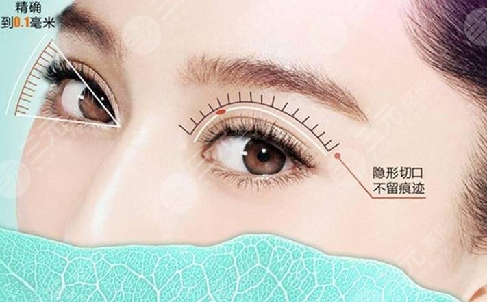 微创双眼皮技术优势