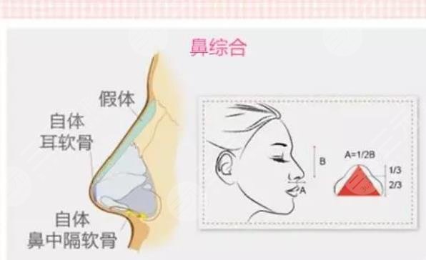 鼻部手术