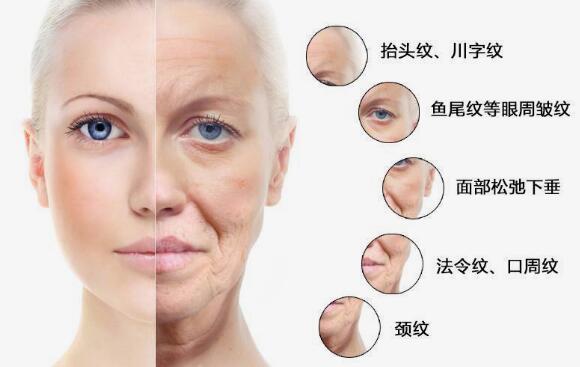 激光除皱维持多久