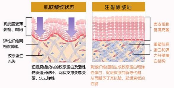 上海除皱手术