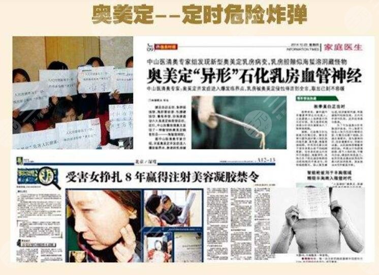 奥美定如何才能够取干净