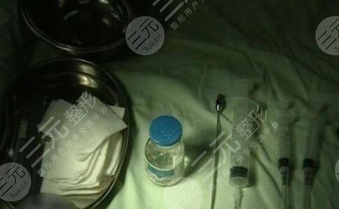 奥美定取出过程