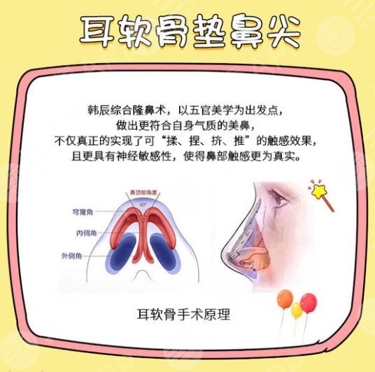 耳软骨鼻子可以维持多久？5年？10年？20年？耳软骨隆鼻经历分享