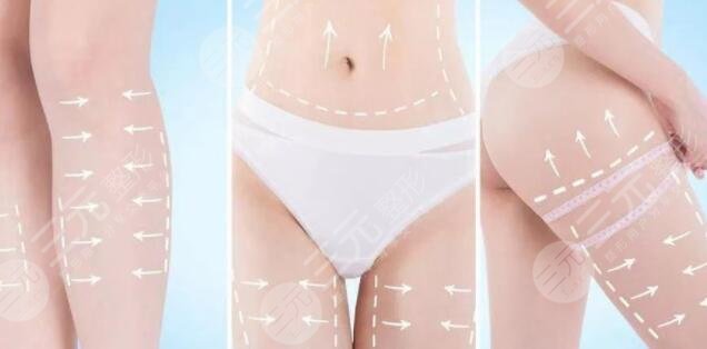 腰部吸脂的优点