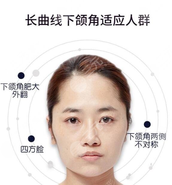 磨骨手术的风险有多大