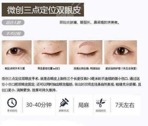 上海九院割双眼皮知识科普
