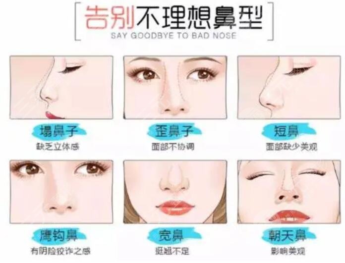 隆鼻失败