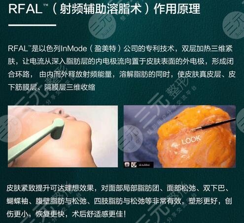 光纤溶脂和吸脂的区别