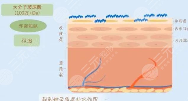 玻尿酸除皱的原理