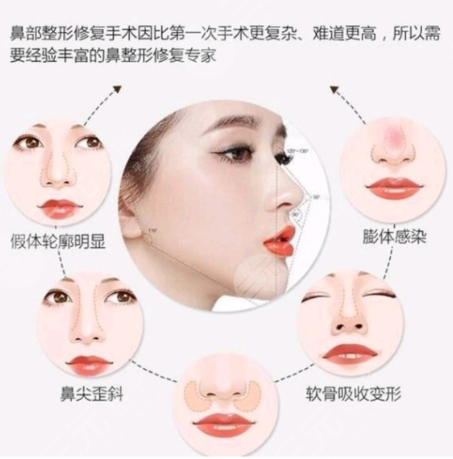 烟台整形医院行业新动态:专业与口碑共飞舞