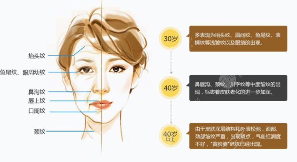 波立塑