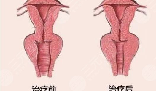 私密激光欧洲之星多少钱，成好吗？2021参考价分享，搞定“内在美”！