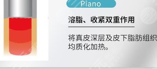 Fotona4D欧洲之星原理