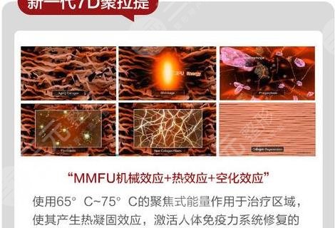 7d聚拉提做脸大概多少钱