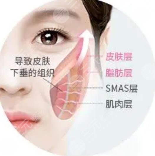 pst面部抗衰手术多少钱？作为过来人告诉你们真相！