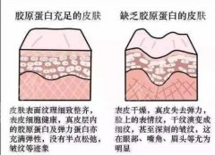 胶原光多久做一次？抗衰如此简单，重塑你的皮肤年龄~
