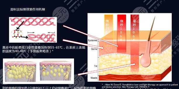 胶原光多久做一次