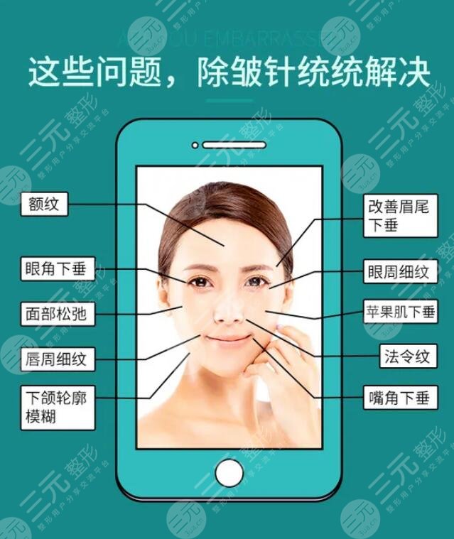 注射注射除皱有啥注