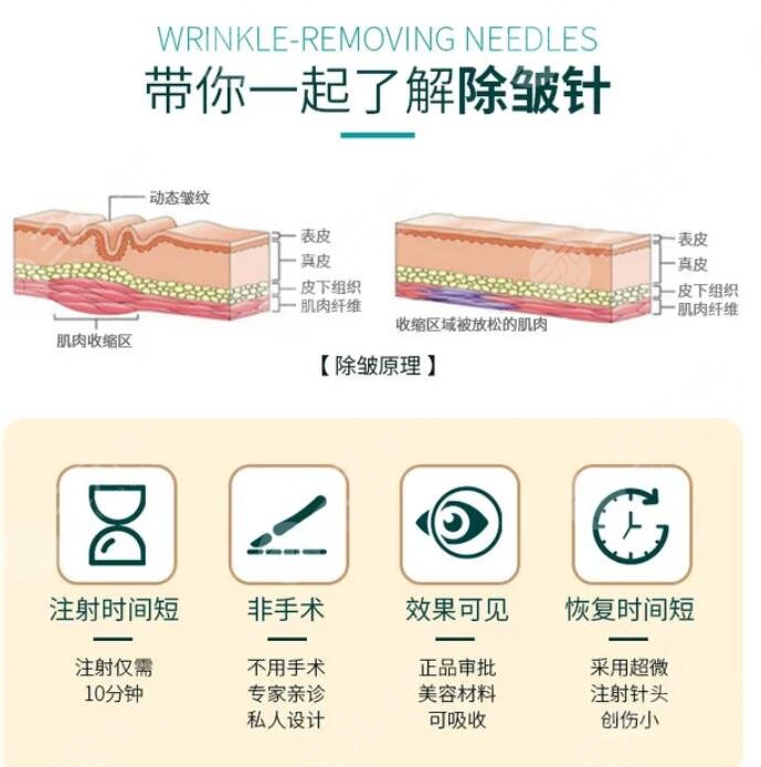 注射除皱是什么原理