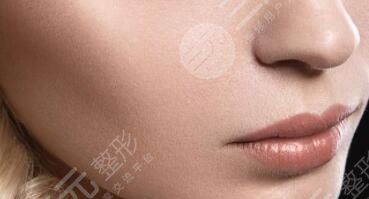 激光除皱术是光子嫩肤吗