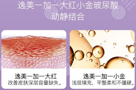 逸美小金