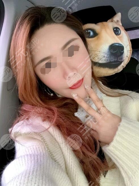 btl射频紧肤真人案例后2个月