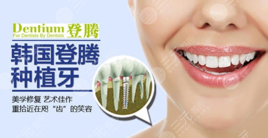 登腾种植牙