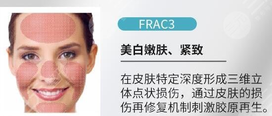 欧洲之星