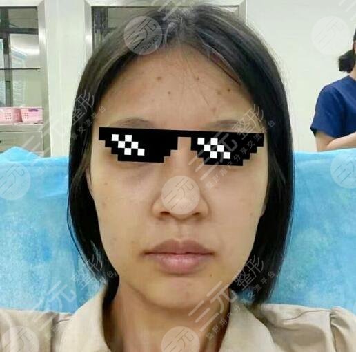 7d聚拉提体验果图