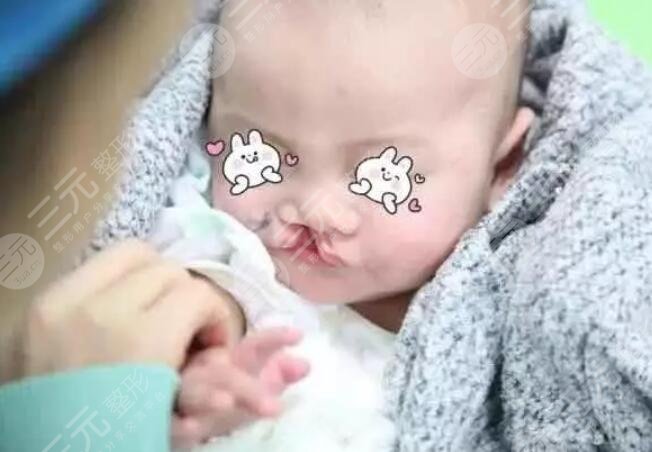 细小的线性疤痕