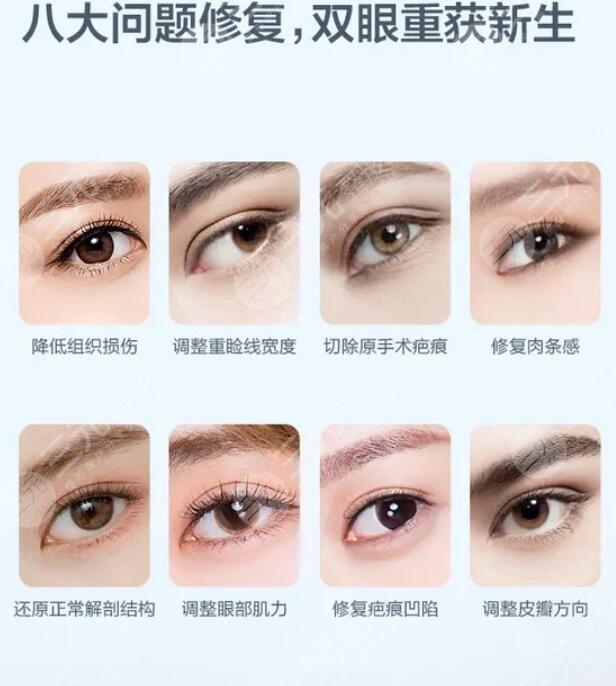 双眼皮修复的**高吗