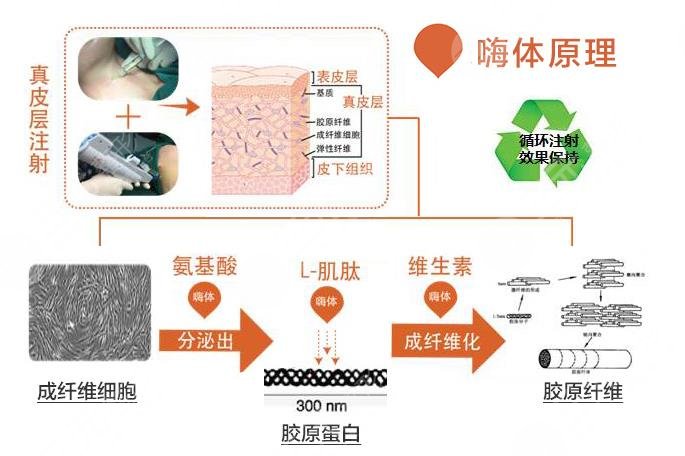 嗨体去颈纹多少钱一支?