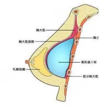 傲诺拉是什么