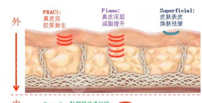 4d火凤凰