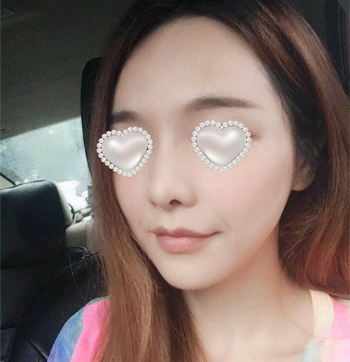 7d聚拉提体验果图