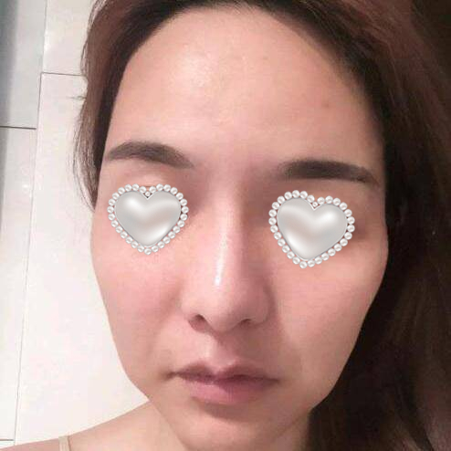 7d聚拉提体验果图