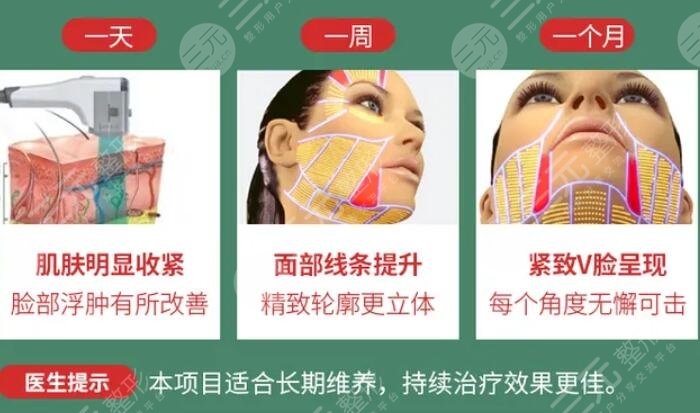 射频紧肤的作用原理是什么