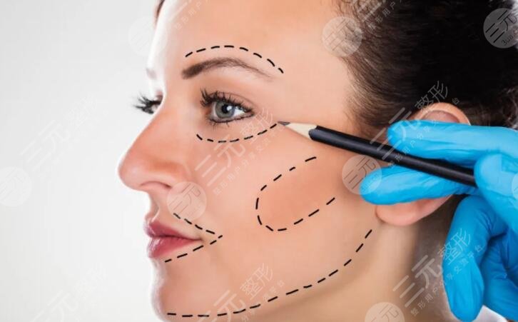 中面部抗衰术是怎么做的？手术过程|费用|真人中面部抗衰术案例