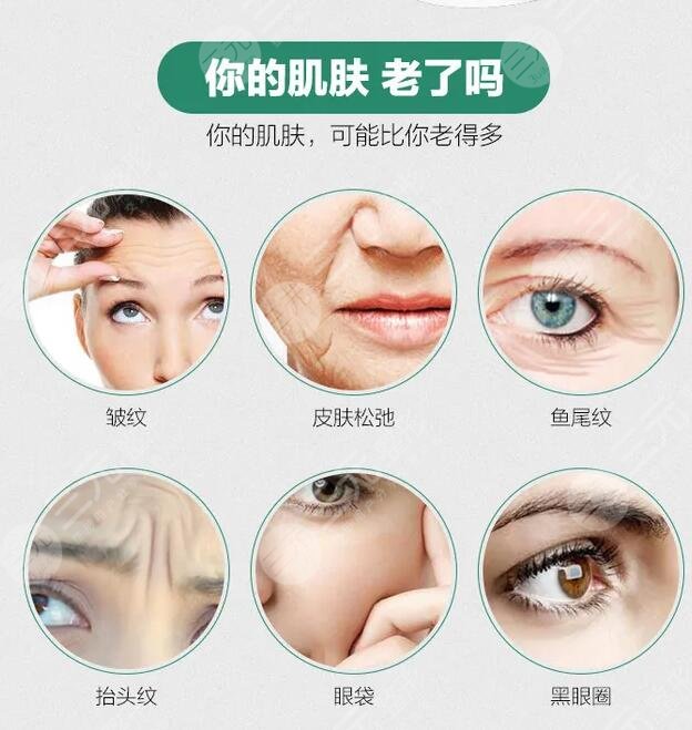 激光除皱有后遗症吗
