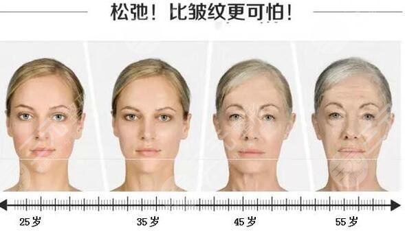脸部皱纹是什么