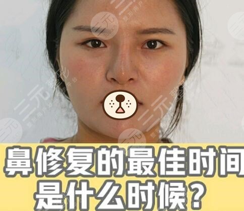 真人做隆鼻修复前