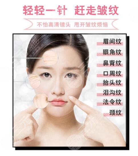 生物注射除皱能持续多久