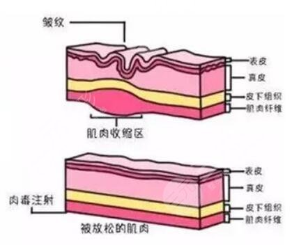 生物除皱抗衰是什么原理