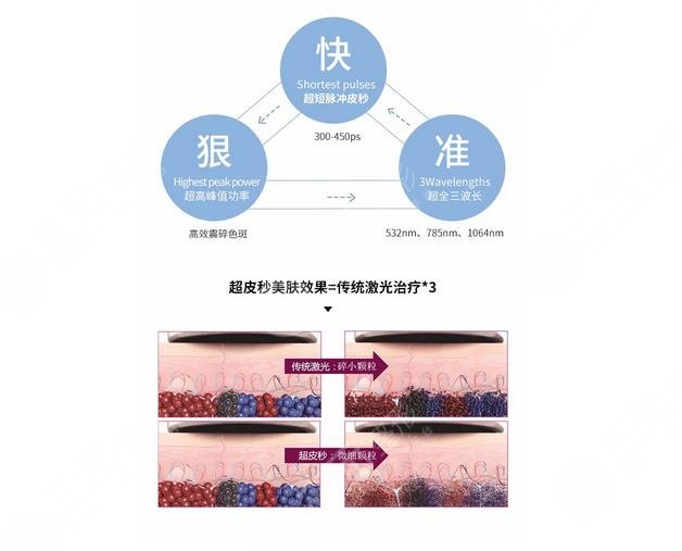 超激光pm祛斑果很好吗|可以维持多久?