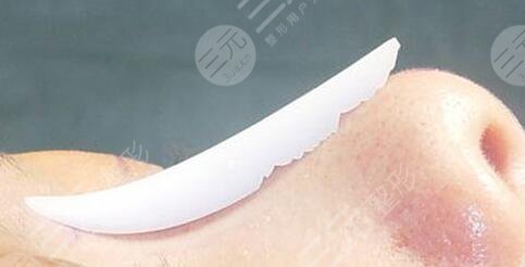 隆鼻时要记住三件重要的事情