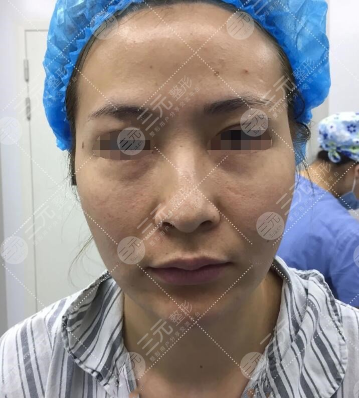 体验btl射频真实果前