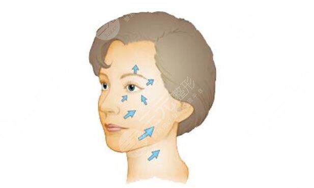 面部拉皮多久能恢复好？手术恢复时期，面部拉皮优势盘点，值得选吗？