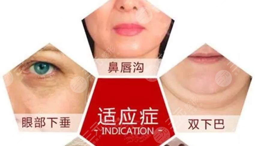 热拉提plus注意哪些事项